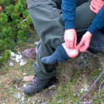 Putting a plaster over a Blister from wearing hiking boots